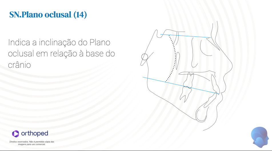 Analise de Steiner - SN.planooclusal