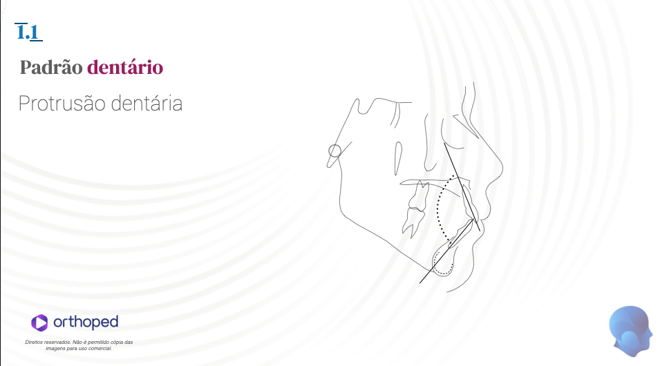 Analise de Steiner. interincisal